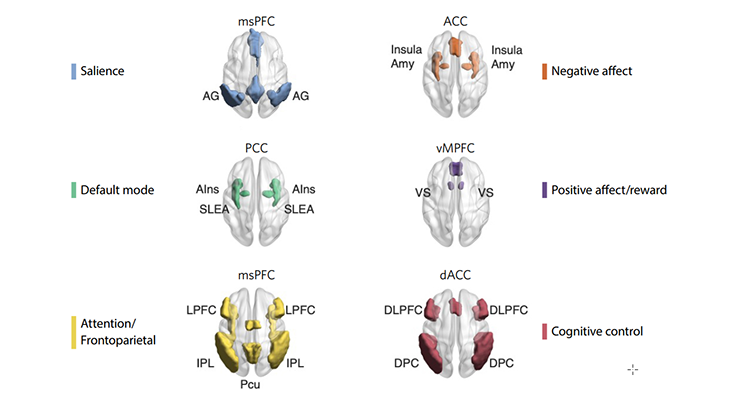 fMRI example fMRI example