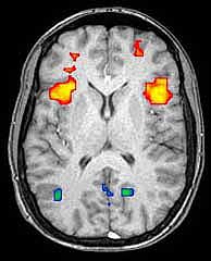 FMRI axial slice image