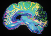 Functional magnetic resonance imaging